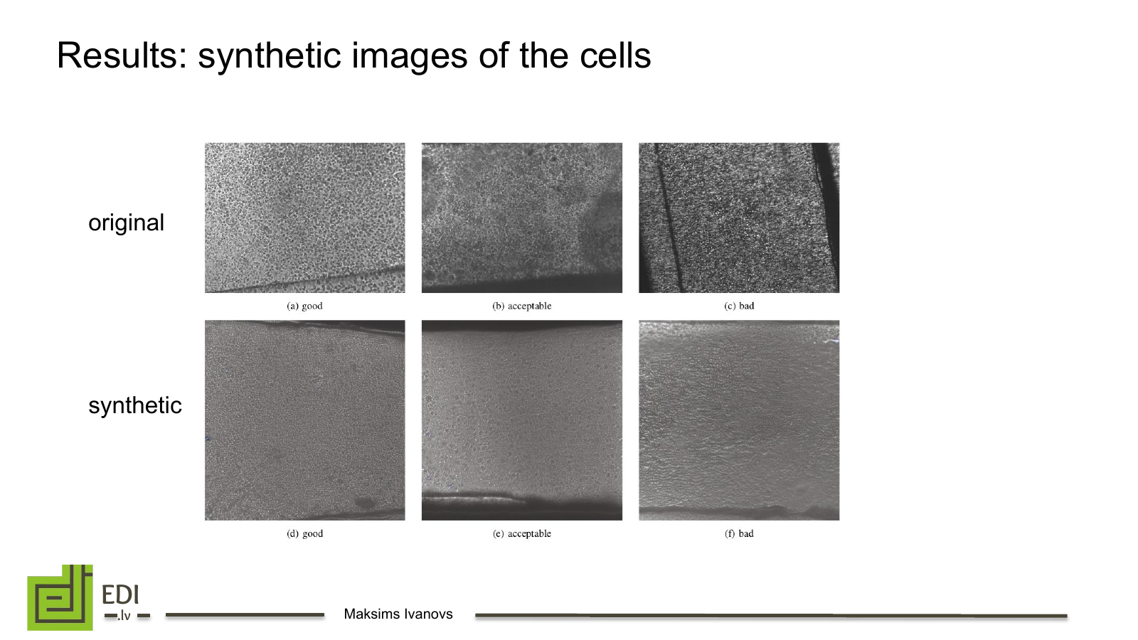 Original and Stable Diffusion generated microscopy images for the good, acceptable and bad classes.